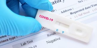 Covid 19-da test proqramında dəyişikliklər edilir