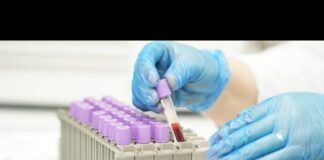 Gürcüstanda hepatit B ilə mübarizə üzrə dövlət proqramı işə salınıb